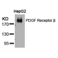 PDGF Receptor b(Ab-751) Antibody
