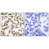 BRCA1(Ab-1423) Antibody