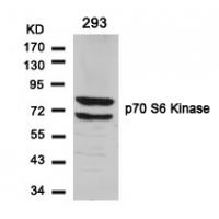 p70 S6 Kinase(Ab-424) Antibody