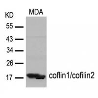 cofilin1/cofilin2(Ab-88) Antibody
