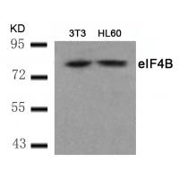 eIF4B(Ab-422) Antibody