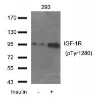 IGF-1R(Phospho-Tyr1280) Antibody