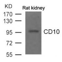 CD10 Antibody
