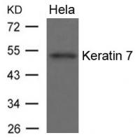 Keratin 7 Antibody