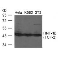 HNF-1b(TCF-2) Antibody