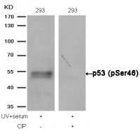 p53(Phospho-Ser46) Antibody