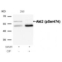 Akt2(Phospho-Ser474) Antibody
