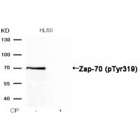 Zap-70(Phospho-Tyr319) Antibody