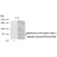 IFNAR1 Subunit1 (phospho-Ser535/Ser539) Antibody