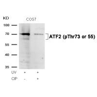 ATF2(Phospho-Thr73 or 55) Antibody