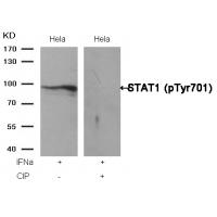 STAT1(Phospho-Tyr701) Antibody