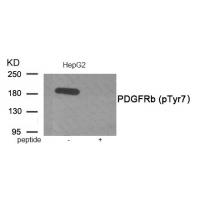 PDGFRb (Phospho-Tyr771) Antibody
