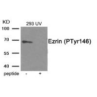 Ezrin (Phospho-Tyr146) Antibody