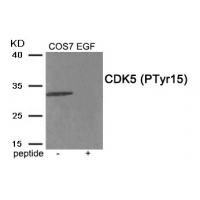 CDK5 (Phospho-Tyr15) Antibody