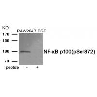 NF-κB p100 (Phospho-Ser872) Antibody