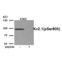 Kv2.1 (Phospho-Ser805) Antibody
