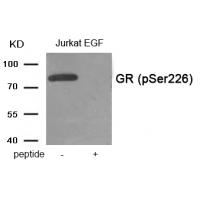 GR (Phospho-Ser226) Antibody