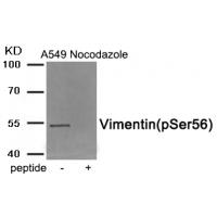 Vimentin (Phospho-Ser56) Antibody