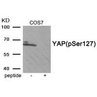 YAP (Phospho-Ser127) Antibody