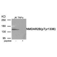 NMDAR2B (Phospho-Tyr1336) Antibody