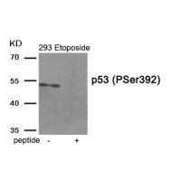 p53 (Phospho-Ser392) Antibody
