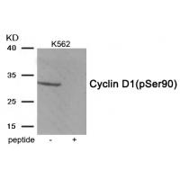 Cyclin D1 (Phospho-Ser90) Antibody