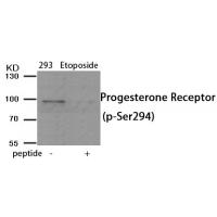 Progesterone Receptor (Phospho-Ser294) Antibody