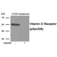 Vitamin D Receptor (Phospho-Ser208) Antibody