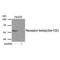 Estrogen Receptor- beta (Phospho-Ser105) Antibody