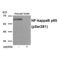 NF- kappaB p65 (Phospho-Ser281) Antibody
