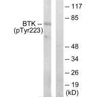 BTK (Phospho-Tyr223) Antibody