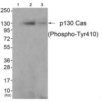p130 Cas (Phospho-Tyr410) Antibody