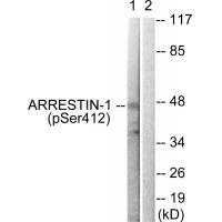 Arrestin 1 (Phospho-Ser412) Antibody