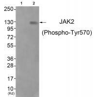 JAK2 (Phospho-Tyr570) Antibody