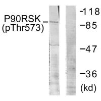 p90 RSK (Phospho-Thr573) Antibody