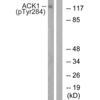 ACK1 (Phospho-Tyr284) Antibody