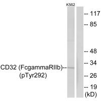 CD32 (Phospho-Tyr292) Antibody