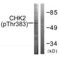 Chk2 (Phospho-Thr383) Antibody