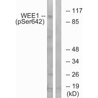 WEE1 (Phospho-Ser642) Antibody