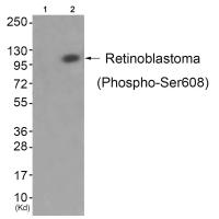 Retinoblastoma (Phospho-Ser608) Antibody