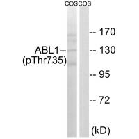 ABL1 (Phospho-Thr735) Antibody