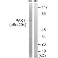 PAK1 (Phospho-Ser204) Antibody