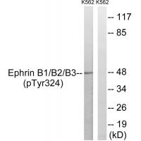 Ephrin B1/B2/B3 (Phospho-Tyr324) Antibody