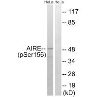 AIRE (Phospho-Ser156) Antibody