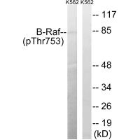 B-Raf (Phospho-Thr753) Antibody