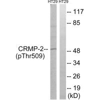 CRMP-2 (Phospho-Thr509) Antibody