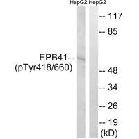 EPB41 (Phospho-Tyr660/418) Antibody