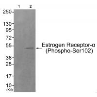 Estrogen Receptor-α (Phospho-Ser102) Antibody