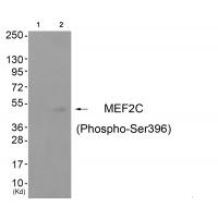 MEF2C (Phospho-Ser396) Antibody