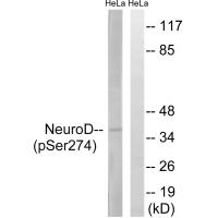 Neuro D (Phospho-Ser274) Antibody